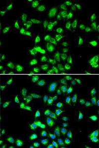 Immunofluorescence analysis of MCF7 cells using Anti-Kallistatin / PI-4 Antibody (A10112). DAPI was used to stain the cell nuclei (blue).