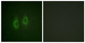 Immunofluorescence analysis of HeLa cells using Anti-Connexin 43 Antibody. The right hand panel represents a negative control, where the Antibody was pre-incubated with the immunising peptide