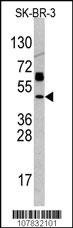 Anti-TP53 Rabbit Polyclonal Antibody