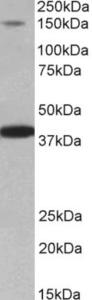 EB11828 (0.2 µg/ml) staining of Mouse Heart lysate (35 µg protein in RIPA buffer). Primary incubation was 1 hour. Detected by chemiluminescence.