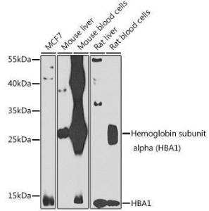 Western blot analysis of extracts of various cell lines, using Anti-Hemoglobin subunit alpha Antibody (A10113) at 1:1,000 dilution The secondary antibody was Goat Anti-Rabbit IgG H&L Antibody (HRP) at 1:10,000 dilution Lysates/proteins were present at 25 µg per lane