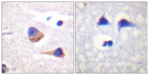 Immunohistochemical analysis of paraffin-embedded human brain using Anti-JAK3 (phospho Tyr785) Antibody. The right hand panel represents a negative control, where the antibody was pre-incubated with the immunising peptide