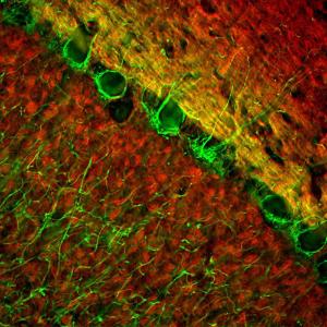 Immunofluorescent analysis of cow cerebellum section stained with Anti-Neurofilament NF-L Antibody (1:2,000 / green), and co-stained with Anti-VLP1 Antibody (1:2,000 / red). Blue is Hoechst staining of nuclear DNA.