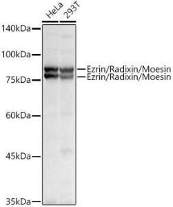 Western blot analysis of extracts of various cell lines, using Anti-Ezrin Antibody (A305803) at 1:1,000 dilution