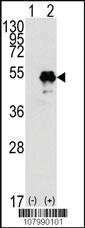 Anti-TP53 Rabbit Polyclonal Antibody