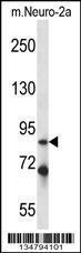 Anti-IRAK1 Rabbit Polyclonal Antibody (APC (Allophycocyanin))