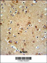 Anti-GMFG Rabbit Polyclonal Antibody