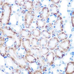 Immunohistochemistry analysis of paraffin-embedded mouse kidney using Anti-CD168 Antibody [ARC0667] (A80858) at a dilution of 1:100 (40x lens). Perform microwave antigen retrieval with 10 mM PBS buffer pH 7.2 before commencing with IHC staining protocol.