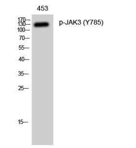 Western blot analysis of 453 cells using Anti-JAK3 (phospho Tyr785) Antibody