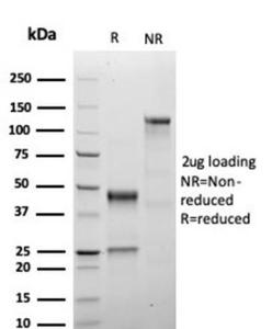 SDS-PAGE analysis of Anti-Growth Hormone Antibody [GH/4886R] under non-reduced and reduced conditions; showing intact IgG and intact heavy and light chains, respectively. SDS-PAGE analysis confirms the integrity and purity of the antibody.