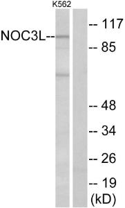 Anti-NOC3L antibody