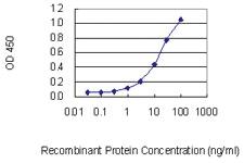 Anti-TCOF1 Mouse Monoclonal Antibody [clone: 8H3]