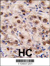 Anti-MINA Rabbit Polyclonal Antibody