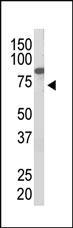 Anti-PIAS2 (PIASx1) Rabbit Polyclonal Antibody