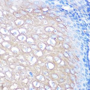 Immunohistochemistry analysis of paraffin-embedded human esophageal using Anti-CD168 Antibody [ARC0667] (A80858) at a dilution of 1:100 (40x lens). Perform microwave antigen retrieval with 10 mM PBS buffer pH 7.2 before commencing with IHC staining protocol.