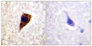 Immunohistochemical analysis of paraffin-embedded human brain tissue using Anti-Connexin 43 Antibody. The right hand panel represents a negative control, where the Antibody was pre-incubated with the immunising peptide