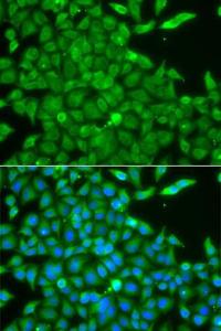 Immunofluorescence analysis of A549 cells using Anti-CSNK1G2 Antibody (A7326). Blue: DAPI for nuclear staining