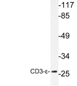 Anti-CD3-epsilon antibody