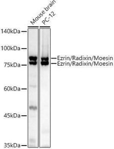 Western blot analysis of extracts of various cell lines, using Anti-Ezrin Antibody (A305803) at 1:1,000 dilution