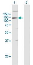 Anti-LLGL2 Mouse Polyclonal Antibody