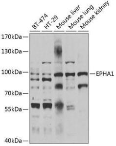 Anti-EPHA1 Rabbit Polyclonal Antibody