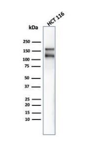 Western blot analysis of HCT-116 cell line lysate using Anti-MSH6 Antibody [MSH6/4592R]