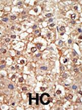 Anti-PIAS4 Rabbit Polyclonal Antibody