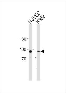 Anti-Transglutaminase Rabbit Polyclonal Antibody (HRP (Horseradish Peroxidase))