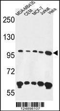 Anti-ANKFY1 Rabbit Polyclonal Antibody (Biotin)