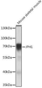 Anti-JP-1 antibody