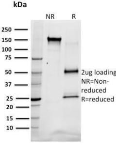 SDS-PAGE analysis of Anti-SREBP1 Antibody [SREBP1/1578] under non-reduced and reduced conditions; showing intact IgG and intact heavy and light chains, respectively SDS-PAGE analysis confirms the integrity and purity of the antibody