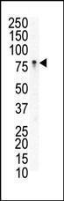 Anti-EPHB3 Rabbit Polyclonal Antibody (Biotin)