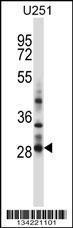 Anti-HOXC4 Rabbit Polyclonal Antibody (FITC (Fluorescein Isothiocyanate))