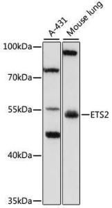 Western blot analysis of extracts of various cell lines, using Anti-ETS2 Antibody (A10117) at 1:1,000 dilution. The secondary antibody was Goat Anti-Rabbit IgG H&L Antibody (HRP) at 1:10,000 dilution.