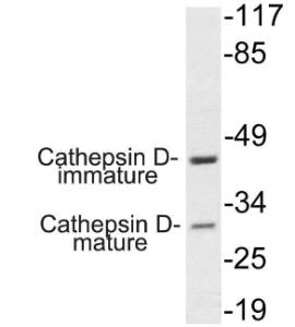 Antibody anti-cathepsind 100 µg