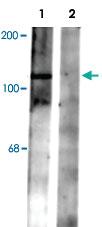 Anti-Gabbr2 Rabbit Polyclonal Antibody