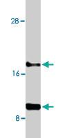 Anti-CCL11 Rabbit Polyclonal Antibody