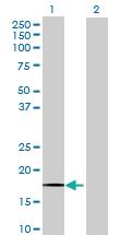 Anti-RFK Mouse Polyclonal Antibody