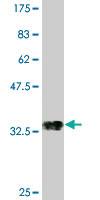 Anti-POU3F2 Mouse Monoclonal Antibody [clone: 1H5]