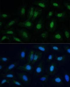 Immunofluorescence analysis of U-2 OS cells using Anti-ETS2 Antibody (A10117) at a dilution of 1:100. DAPI was used to stain the cell nuclei (blue).