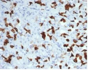 Immunohistochemical analysis of formalin-fixed, paraffin-embedded human salivary gland tissue using Anti-MSH6 Antibody [MSH6/7065R]