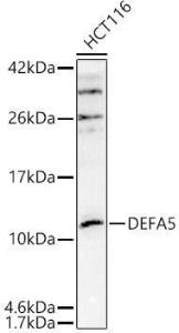 Western blot analysis of extracts of HCT116 cells, using Anti-alpha Defensin 5 Antibody (A305804) at 1:1,000 dilution. The secondary antibody was Goat Anti-Rabbit IgG H&L Antibody (HRP) at 1:10,000 dilution.