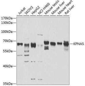 Western blot analysis of extracts of various cell lines, using Anti-KPNA5 Antibody (A10118) at 1:1000 dilution