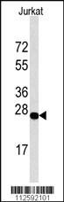 Anti-DDIT4 Rabbit Polyclonal Antibody