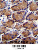 Anti-LRWD1 Rabbit Polyclonal Antibody (FITC (Fluorescein Isothiocyanate))