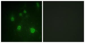 Immunofluorescence analysis of COS7 cells using Anti-HMG14 (phospho Ser21) Antibody. The right hand panel represents a negative control, where the antibody was pre-incubated with the immunising peptide