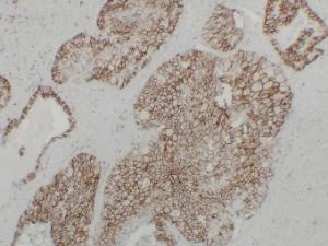 Anti-Cadherin 16 antibody