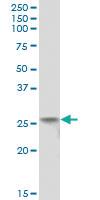 Anti-TMA16 Mouse Polyclonal Antibody