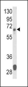 Anti-Glutaminase, Kidney Isoform, Mitochondrial Rabbit Polyclonal Antibody (FITC (Fluorescein))