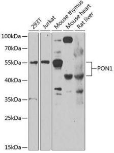 Western blot analysis of extracts of various cell lines, using Anti-PON1 Antibody (A10119) at 1:1,000 dilution